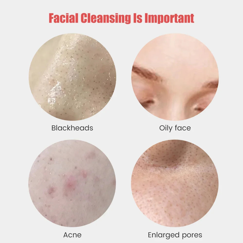 Deep Pore Facial Cleansing Massager